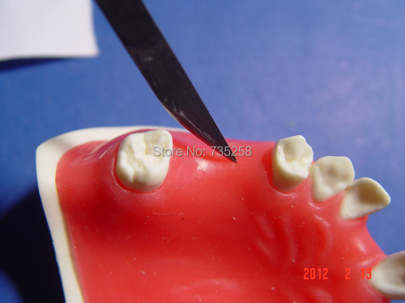Tooth Planting Practice Model,Gum Fill Planting Practice Model,Missing Teeth Planting Skill Training Model