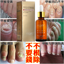 Fungal recover health to Nail onychomycosis Treatment Herbaceous energy Essence Foot Whitening Fungus Removal Care Gel