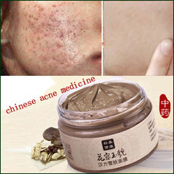 Gromwell-Root-facial-mask-acne-scars-remover-mite-face-care-treatment-blackhead-whitening-cream-skin-care