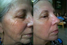 2pcs 2X10ml Boto x Instantly Ageless Face Lift Firming Skin Care Product Concentrate Powerful Anti-wrinkle Anti-aging
