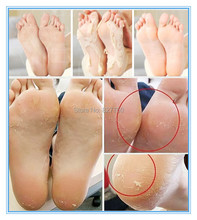 Hot 1packs Peeling Feet Mask exfoliating socks Baby Care Pedicure Socks Remove Dead Skin Cuticles Suso
