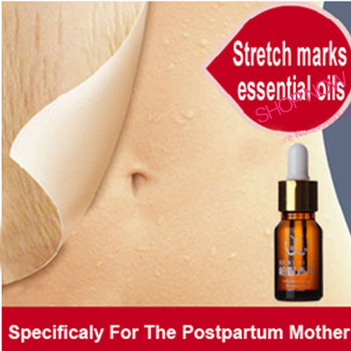 Female Stretch marks essential oils prenatal postpartum potent olive oil repair cream obesity pregnancy scar removal