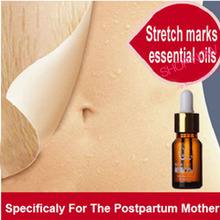 Female Stretch marks essential oils prenatal postpartum potent olive oil repair cream obesity pregnancy scar removal cream oil