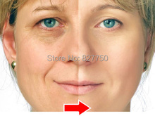 5Pcs six peptides serum for striae Anti Wrinkle Cream anti aging collagen rejuvenating face lift skin