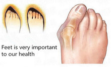  Bone thumb Broadhurst day and night orthotast of recitification toes hallux valgus correction foot care