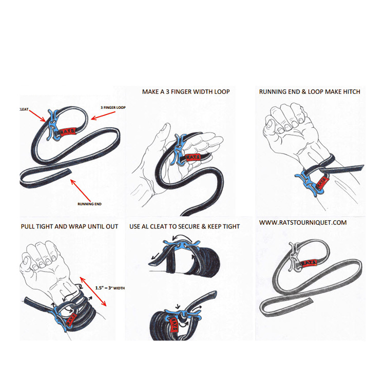 Купить военной спецификации требования жгут брюшного артериолы garrot