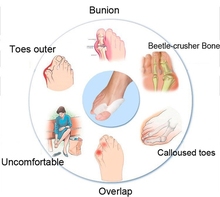 1pairs 2pcs Hot Latest styles Silicone toe separator Toe protection Correction thumb Valgus adjustment