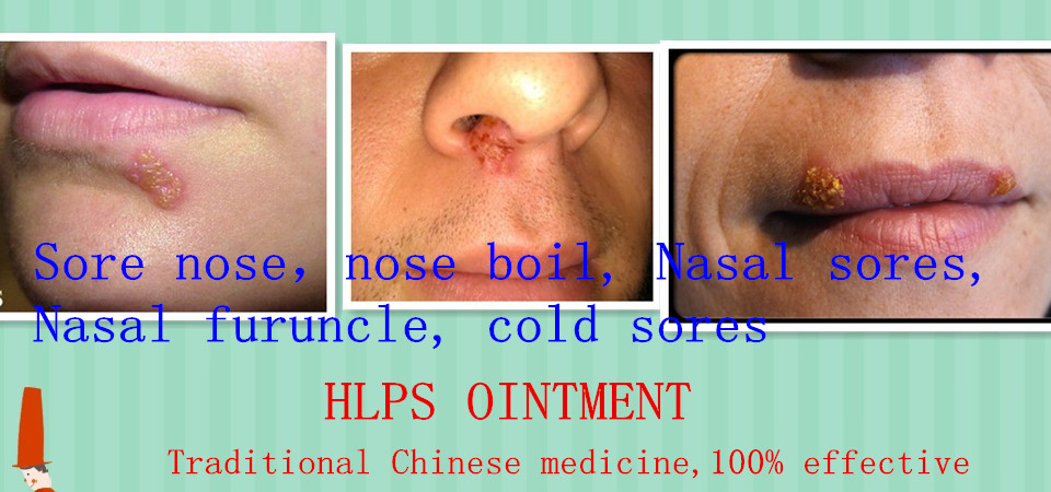 sore inside nose that won t heal