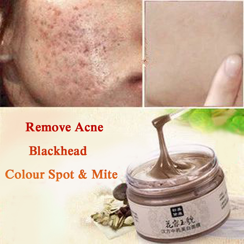 acne face masks are excellent natural remedies for getting rid of acne 