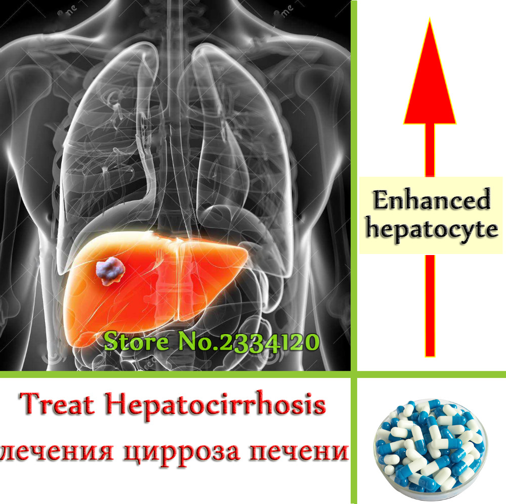 История болезни метастазы печени