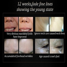 Argireline liquid six peptides serum for striae Anti Wrinkle Cream anti aging Collagen rejuvenating face lift