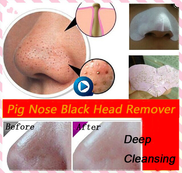 Buy Black Head Remover Tool