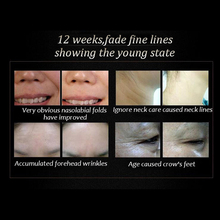 1pcs Argireline aloe vera collagen peptides rejuvenation anti wrinkle Serum for the face skin care products
