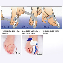 Hot Beetle crusher Bone Ectropion Toes outer Appliance Professional Technology Health Care Product 2 pcs left