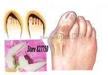 2pairs Free shipping New Hotsale Beetle crusher Bone Ectropion Toes outer Appliance Professional Technology Health Care
