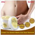 Cream For Stretch Marks And Scar Removal Powerful To Stretch Marks Maternity Skin Body Repair Cream