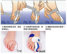 1pair Hot Beetle crusher Bone Ectropion Toes outer Appliance Professional Technology Health Care Product left and