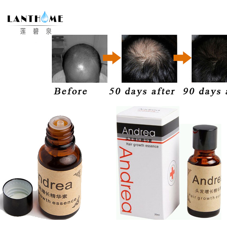 2015-new-Best-Hair-regrowth-Treatment-Product-Andrea-hair-growth ...