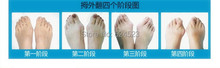 5pairs lot Hot Soft Beetle crusher Bone Ectropion Toes outer Appliance Silica Gel Toes Separation Health