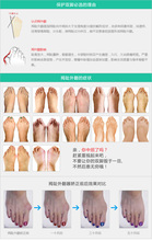 Hot selling seperating gel bunion shield Toe Separators Stretchers Bunion Protector Straightener Corrector pedicure foot care