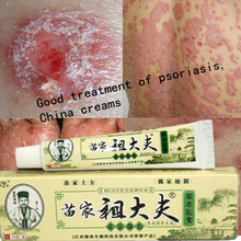 Psoriasis dermatitis and eczema pruritus psoriasis skin problems China creams psoriasis creams