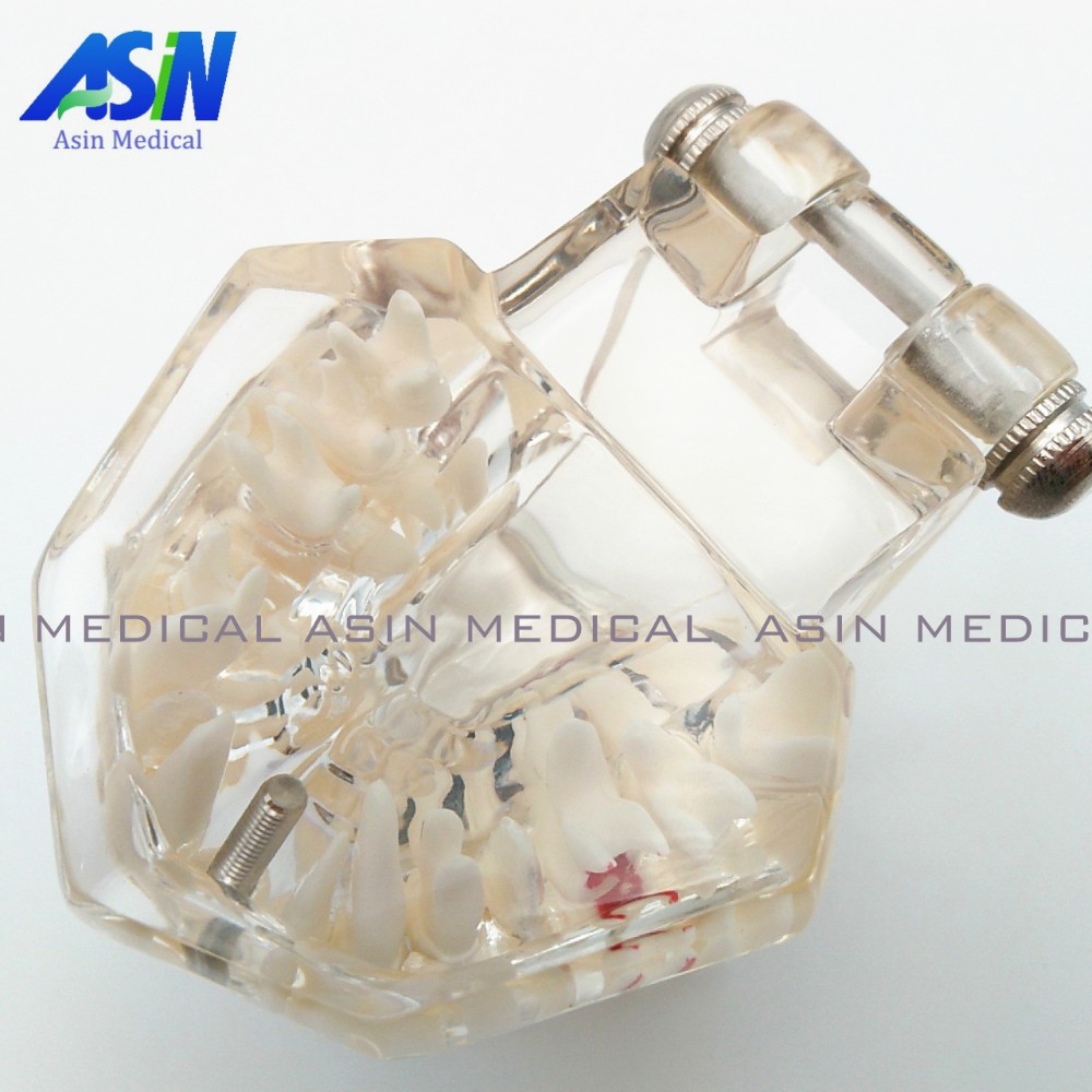 High Quality NEW arrival Dental implant Demonstration Bracket High Quality NEW arrival Dental implant Demonstration Bracket Simulation Caries Teeth Model teeth removable Dentist us826
