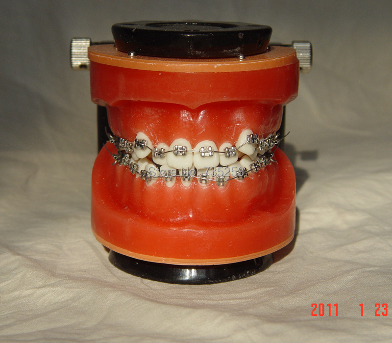 Senior Wax Dike Orthodontic Practice Model,Wax Dike Teeth Orthodontic Practice Model,Wax Dike Wrong Jaw Correction Model