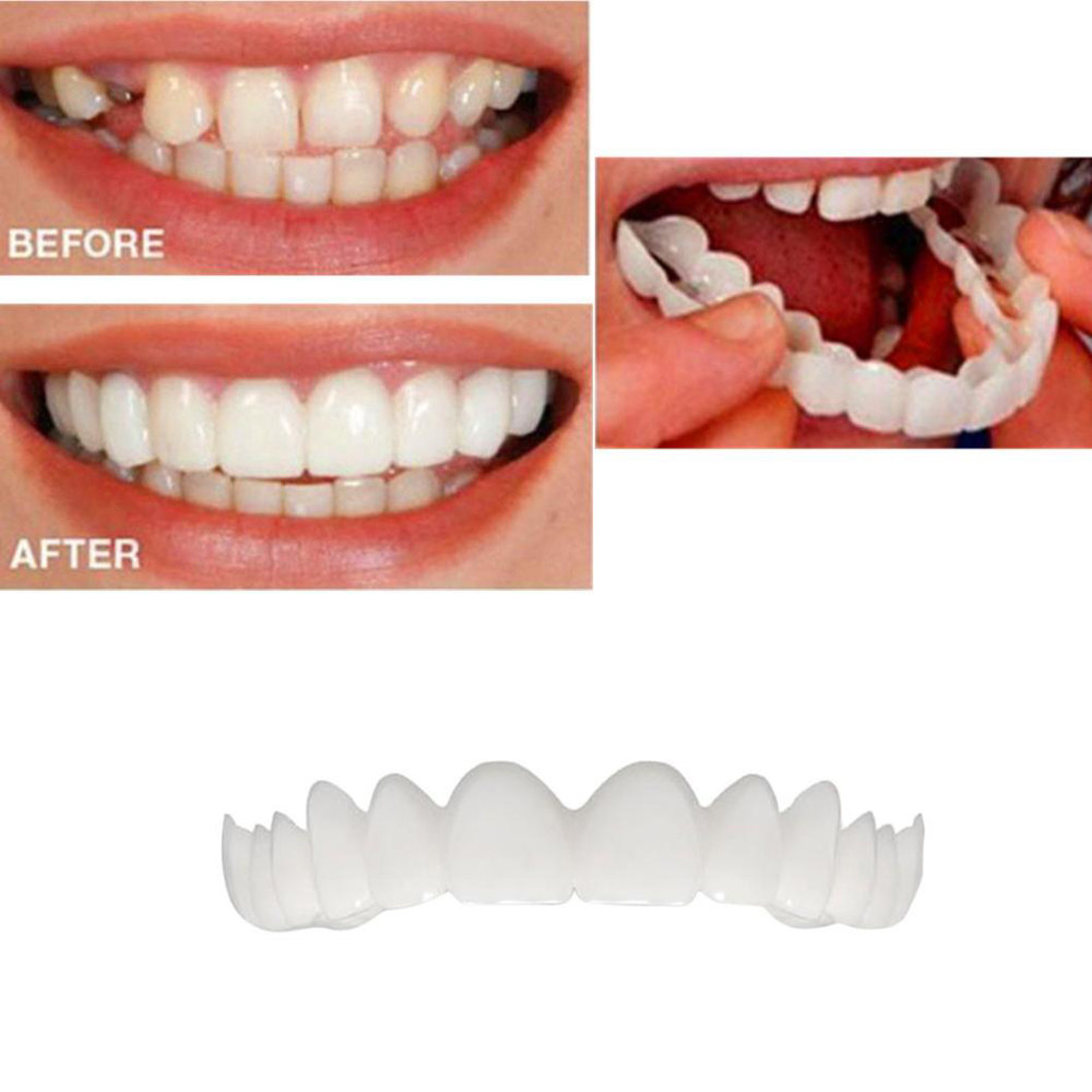 Зубные виниры комплект temporary Tooth smile